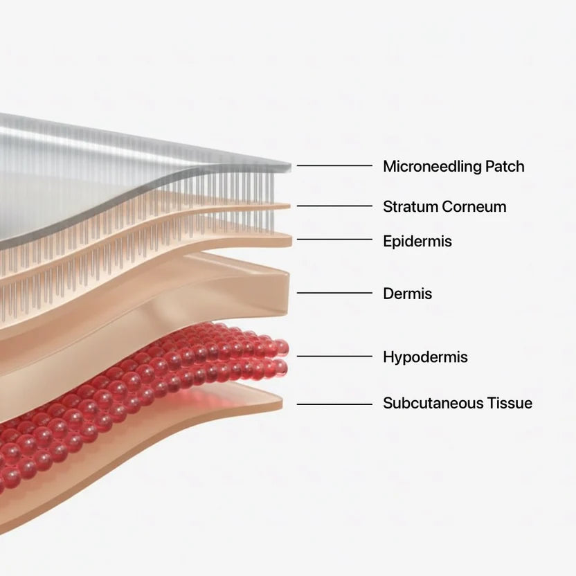 Micro-Needle Peptide Patches
