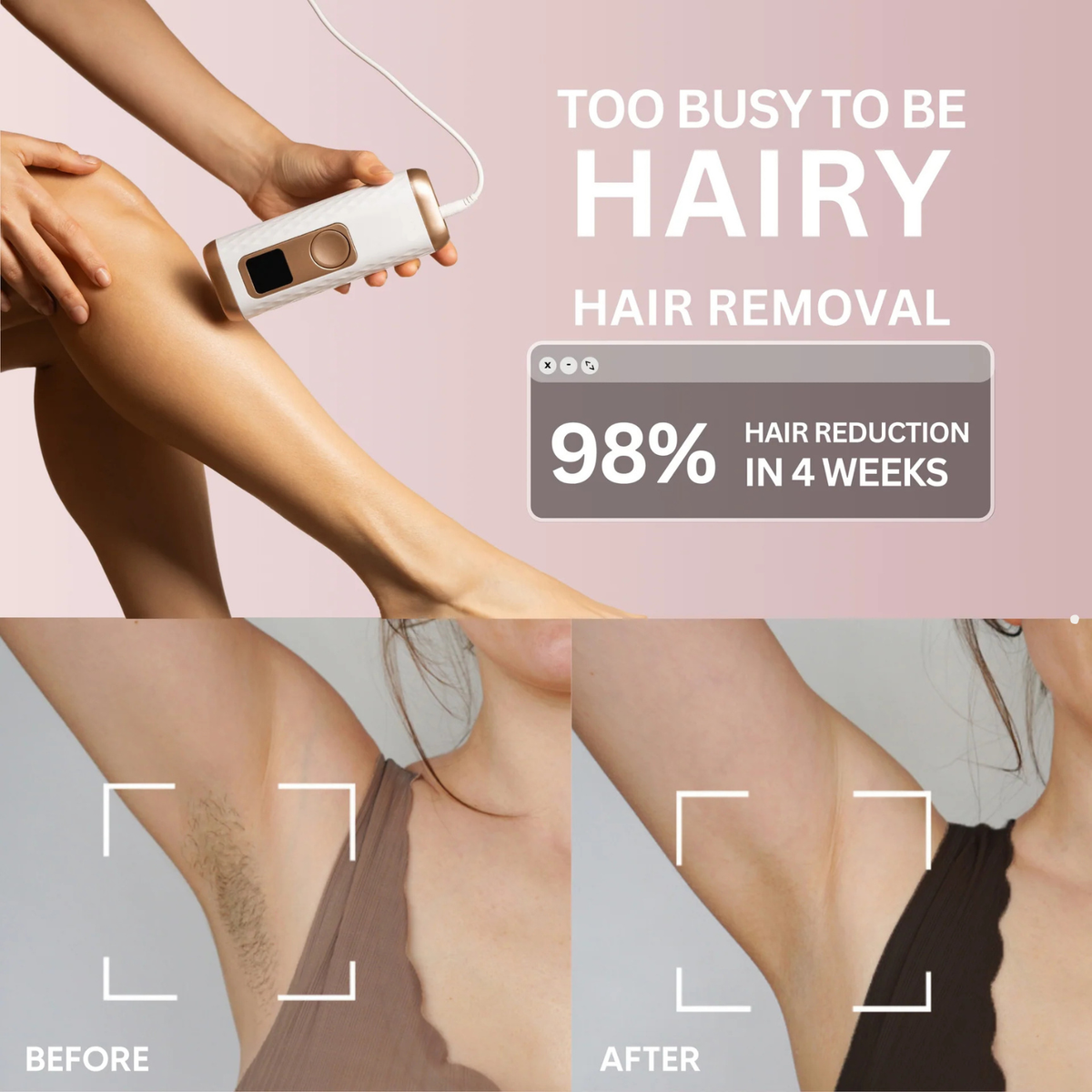 ICE IPL at home laser