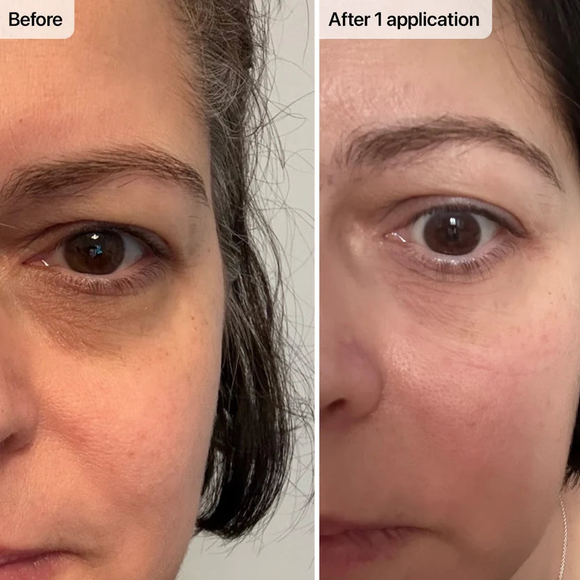 Micro-Needle Peptide Patches